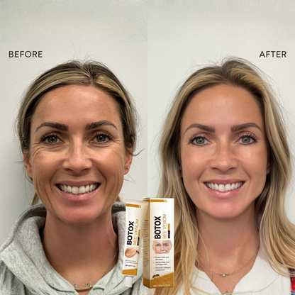 Apiluxe™ Bee Venom Youth Cream